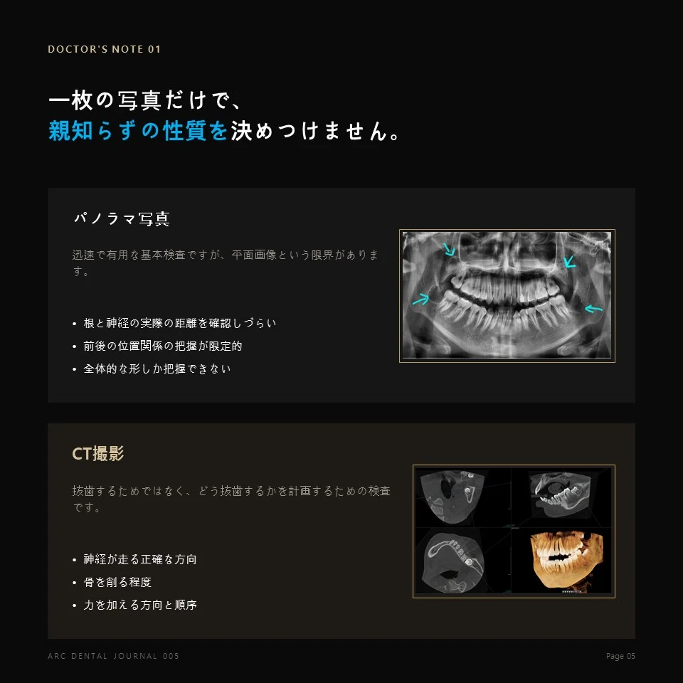 一枚の写真だけで親知らずの性質を決めつけません
