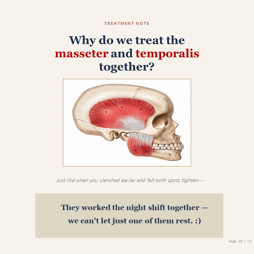 Jongno bruxism botox - why ARC Dental treats the masseter and temporalis together Jongno bruxism botox - why do we treat the masseter and temporalis together