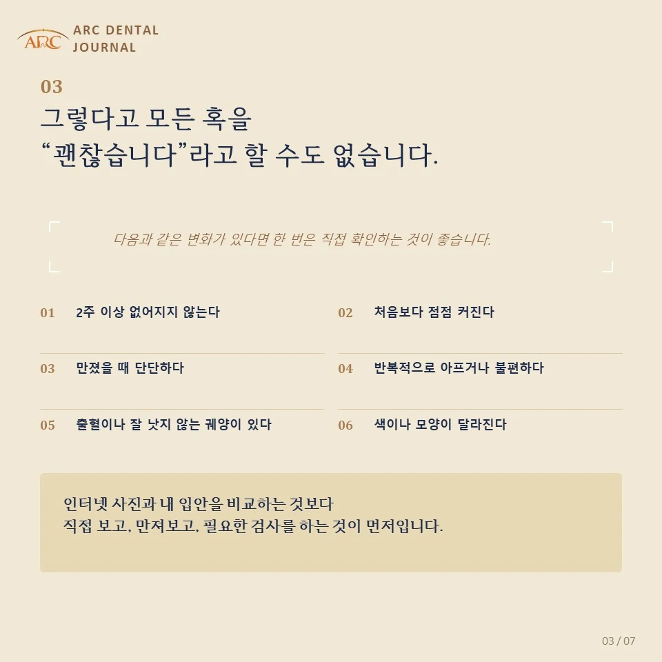 그렇다고 모든 혹을 괜찮습니다라고 할 수 없습니다 — 직접 확인이 필요한 변화