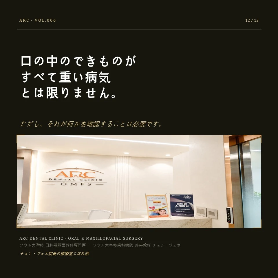 口の中のできものがすべて重い病気とは限りません