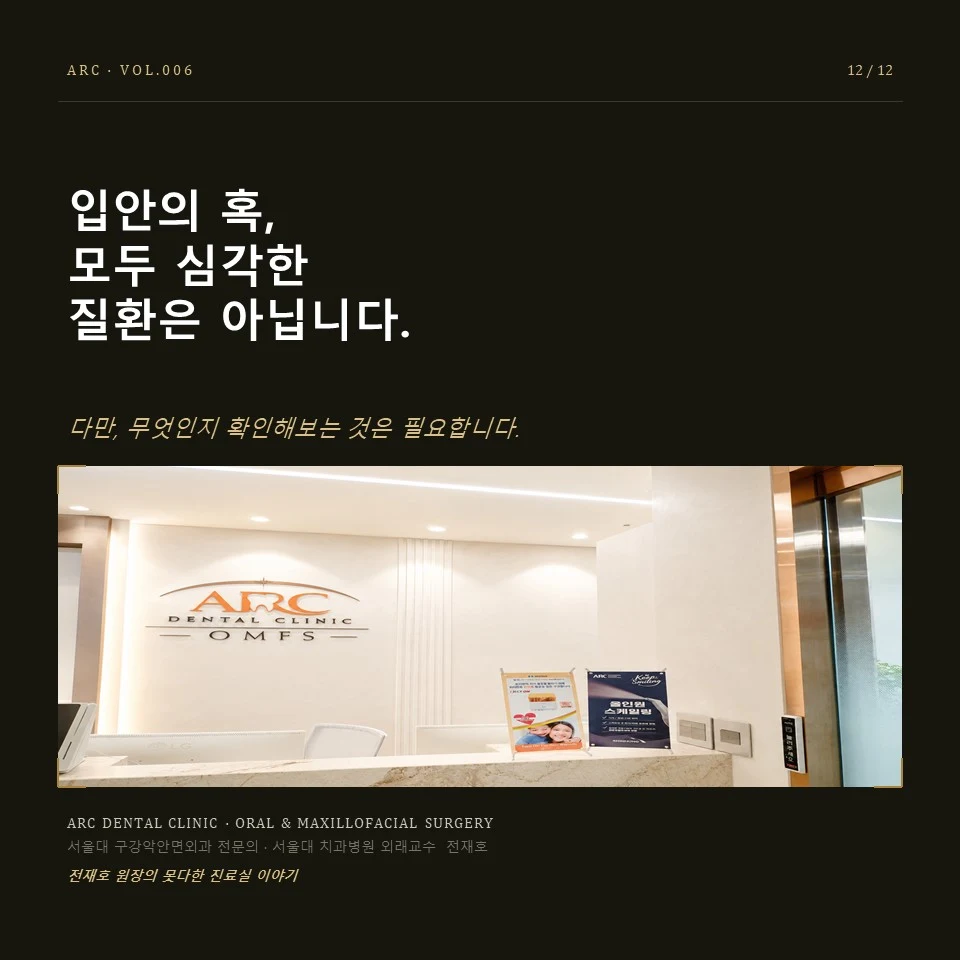 입안의 혹, 모두 심각한 질환은 아닙니다