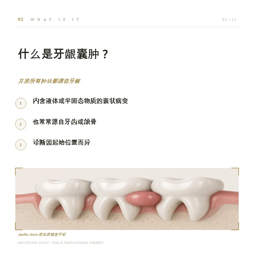 什么是牙龈囊肿?