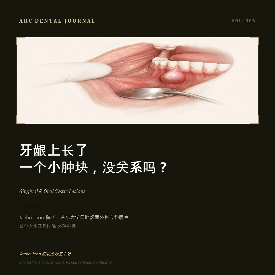 牙龈上长了一个小肿块,没关系吗?