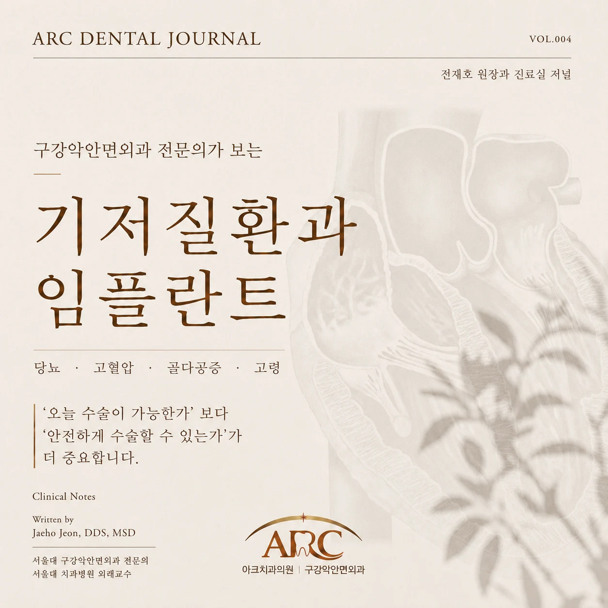 기저질환(전신질환)과 임플란트, 구강악안면외과 전문의가 보는 관점