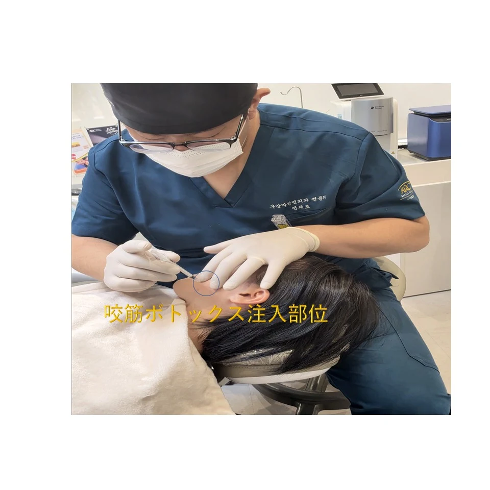 鍾路の歯ぎしりボトックス - 咬筋ボトックス注入部位、咬筋を直接治療
