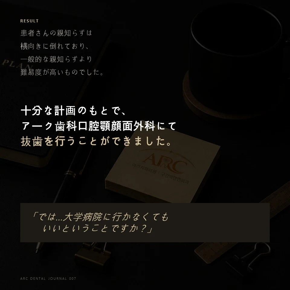 十分な計画のもとでアーク歯科口腔顎顔面外科にて抜歯完了