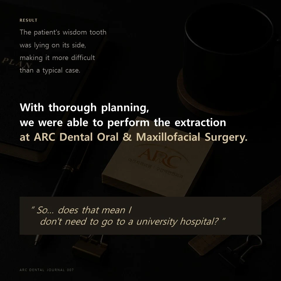 Result - With thorough planning, wisdom tooth extraction performed at ARC