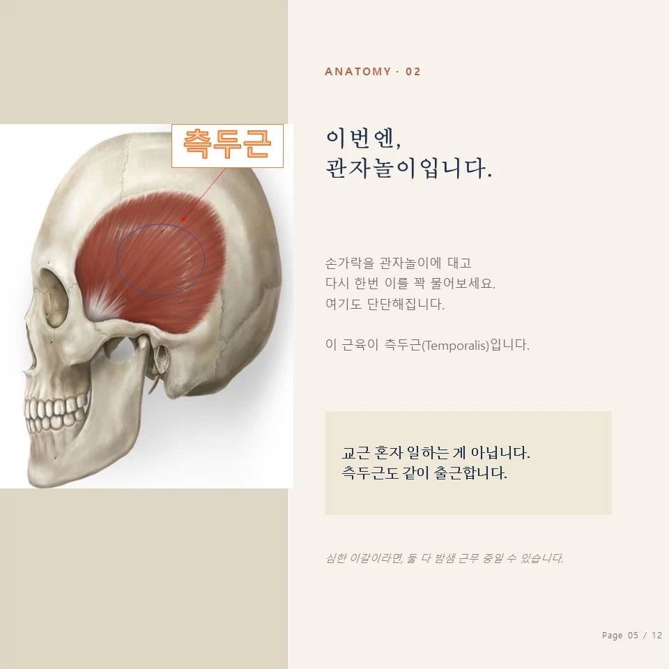 측두근 보톡스 - 종로 이갈이 보톡스 측두근(Temporalis) 위치 - 관자놀이 측두근 보톡스 주입 부위