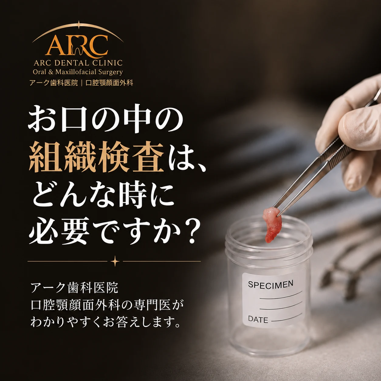 口腔内組織検査、どんな場合に必要でしょうか? | 口腔顎顔面外科専門医 | ARC歯科医院