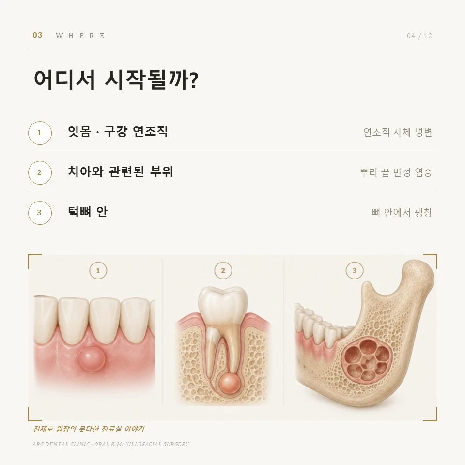 어디서 시작될까?
