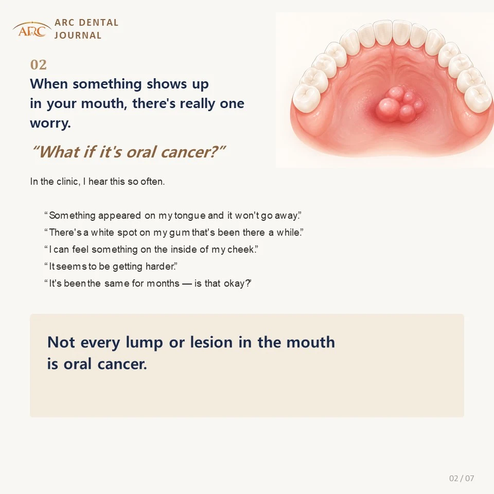 When something appears in the mouth the first thought is oral cancer